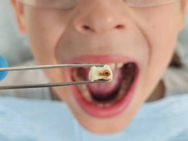 Best Emergency Dentist for Special Needs Patients in St Peter, WI